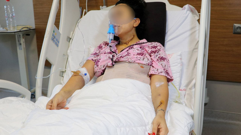 Adana'da dehşeti yaşadı! Midesinin yüzde 30'u alınan Burcu'ya 135 dikiş atıldı - Resim: 4