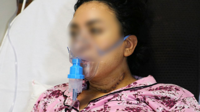 Adana'da dehşeti yaşadı! Midesinin yüzde 30'u alınan Burcu'ya 135 dikiş atıldı - Resim: 3