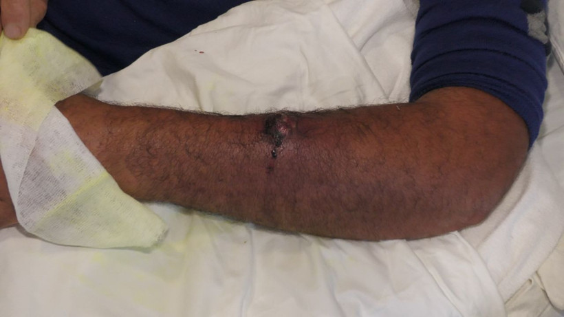 Kasaptan aldığı etten 'şarbon' kaptı! Kasap dükkanı kapatıldı - Resim: 3