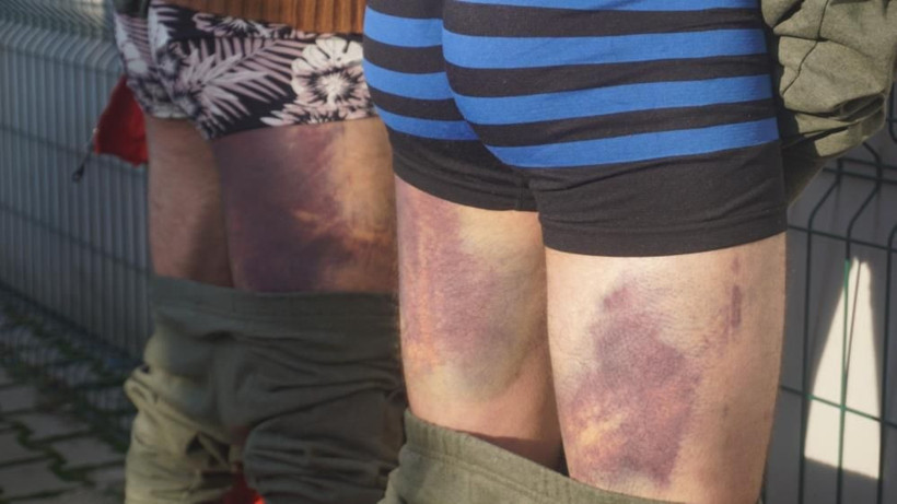 Yunanistan bir kez daha ölüme itti: Soydular, dövdüler, çıplak halde geri gönderdiler - Resim: 2