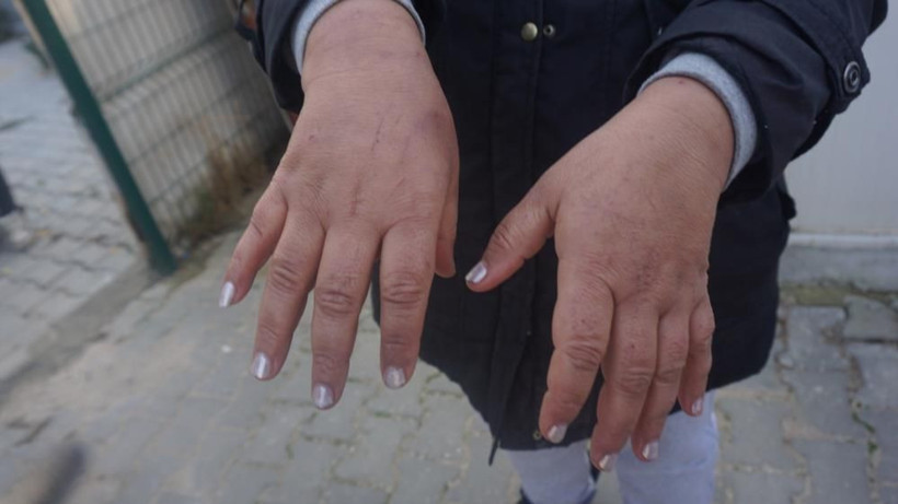 Yunanistan bir kez daha ölüme itti: Soydular, dövdüler, çıplak halde geri gönderdiler - Resim: 4