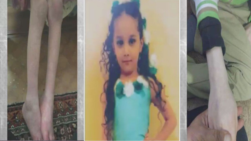 Nur Elif'in öldüğü evin içi dehşete düşürdü! Eskişehir'i sarsan 3 çocuğun işkence evi - Resim: 2