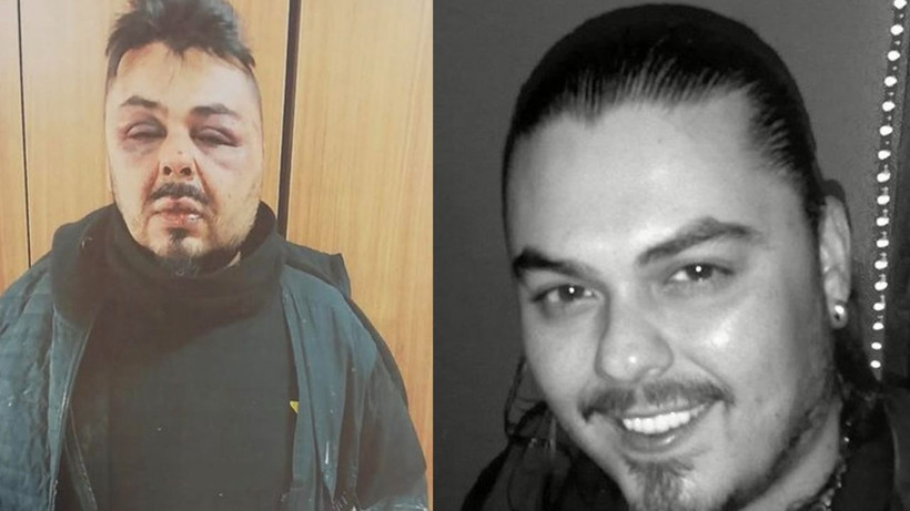 DM'den yürüyünce! Kemikleri kırılana kadar dayak yedi, Şarkıcı Hakan Akayran tanınmaz halde - Resim: 4