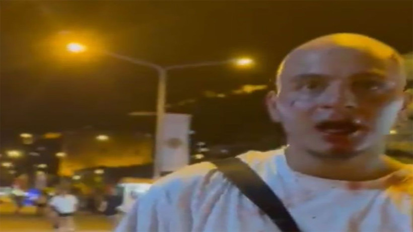 Tatile gelen gurbetçi gence 6 kişi birden sopayla saldırdı! - Resim: 4