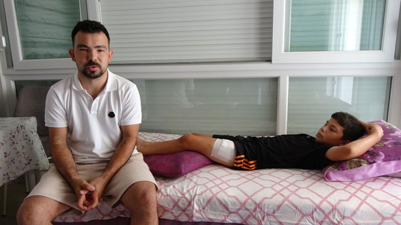 Başıboş köpekler Antalya'da küçük çocuğa dehşet yaşattı! 11 yaşındaki çocuğun baldırını kopardı - Resim: 3