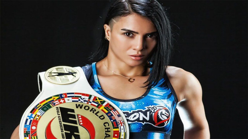 Estetikten tanınmaz hale geldi! Survivor'ın Sabriye'si yeni imajıyla bambaşka biri oldu - Resim: 2