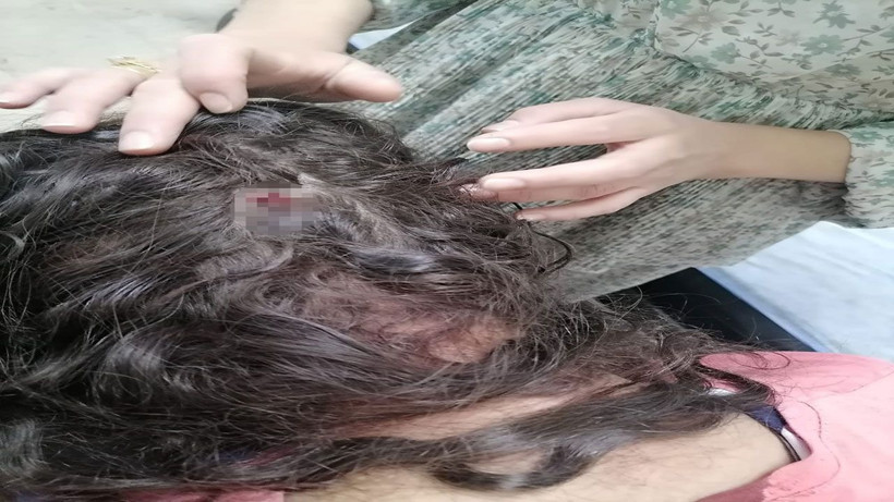 İki kız çocuğuna markette korkunç saldırı! Ağabeylerinin eski eşinin yakınları tarafından öldüresiyle dövüldüler - Resim: 4