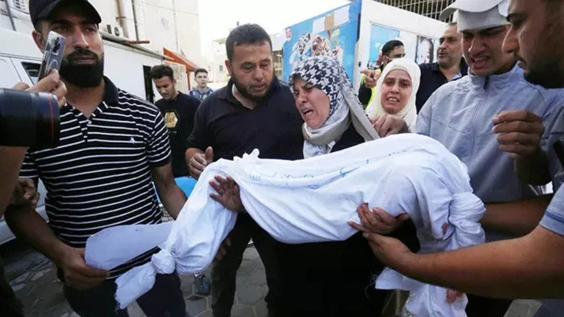 Kafası kopmuş çocukları anlatırken kelimeler boğazında düğümlendi! Gazze'den yürek yakan fotoğraflar... - Resim: 1