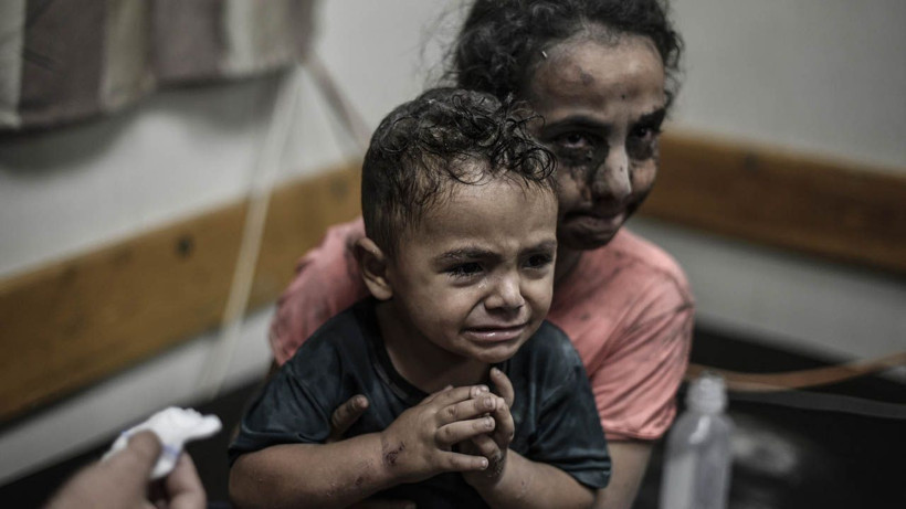 Kafası kopmuş çocukları anlatırken kelimeler boğazında düğümlendi! Gazze'den yürek yakan fotoğraflar... - Resim: 2