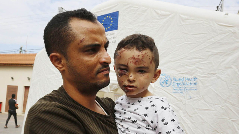 Kafası kopmuş çocukları anlatırken kelimeler boğazında düğümlendi! Gazze'den yürek yakan fotoğraflar... - Resim: 3