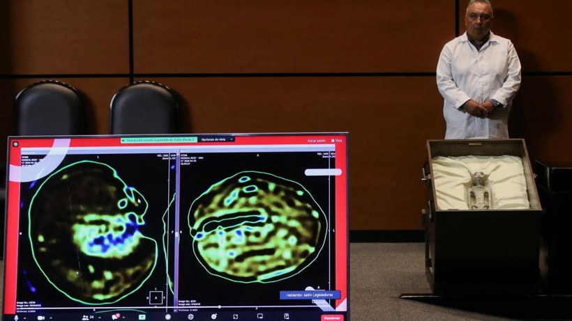 DNA sonuçları çıktı! Meclis'te gösterilen cesetler insana ait değil! Uzaylılar denilmişti... - Resim: 3