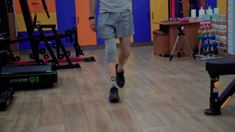 Sokakta yürürken bombanın hedefi oldu, kaybettiği organlarına protezle kavuştu! - Resim: 3