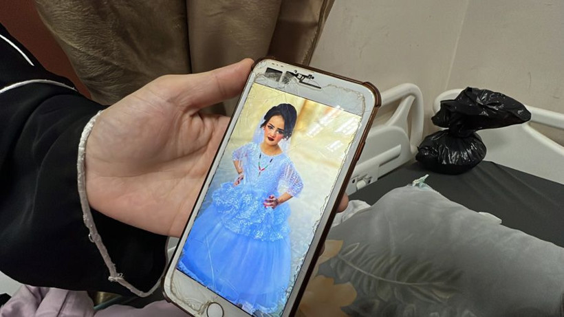 İsrail ordusunun Gazze'deki saldırısında Filistinli küçük kız bu halden bu hale geldi - Resim: 2