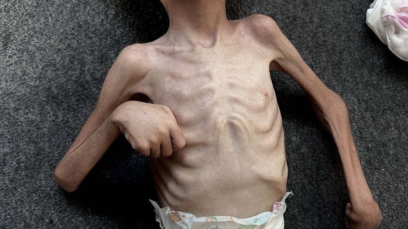 Gazze'den kahreden görüntüler! 6 yaşındaki Kerim yaşam mücadelesi veriyor - Resim: 2