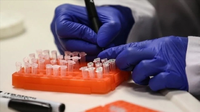 Gana'da M çiçeği vaka sayısı artıyor! - Resim: 1