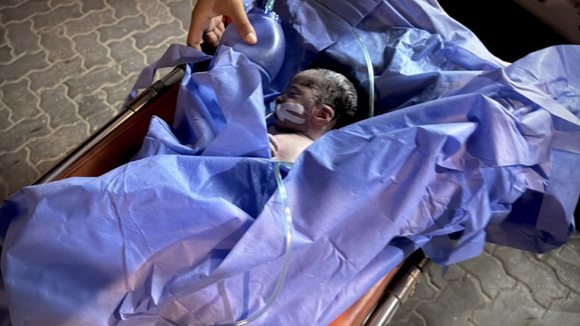 Katliam kan dondurmaya devam ediyor! Saldırıda ölen hamile kadının bebeği kurtarıldı - Resim: 1