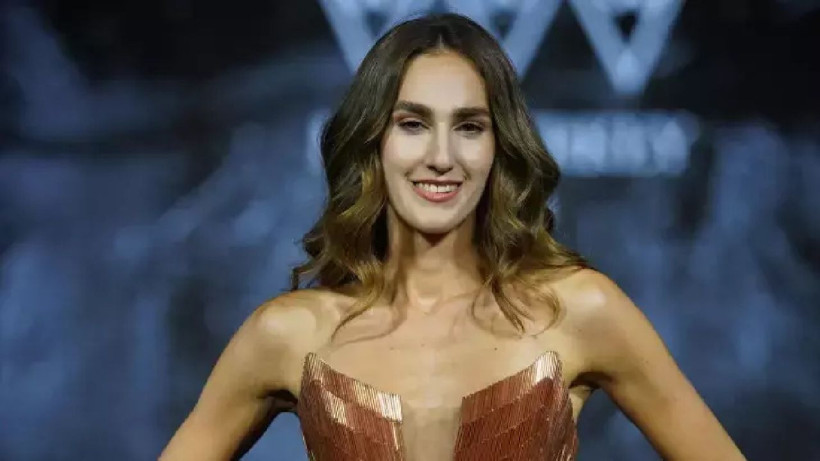 Türkiye'yi temsil edecek Ayşe Sena Şeref botokslu dendi işte olay olan güzel - Resim: 1