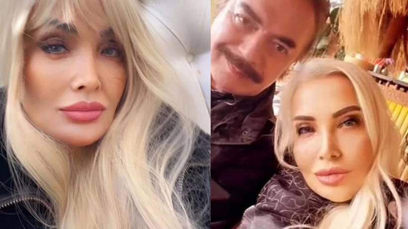 Orhan Gencebay'ın hayat arkadaşı Sevim Emre filtreyi abarttı... - Resim: 2