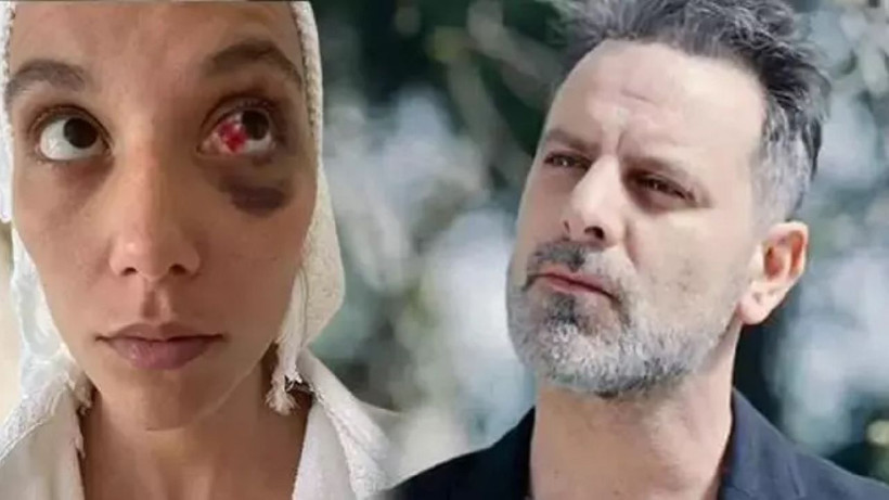 Çağla Şikel çark etti! Şiddet göstermesini eleştirmişti ama aynı projede yer alacak - Resim: 3