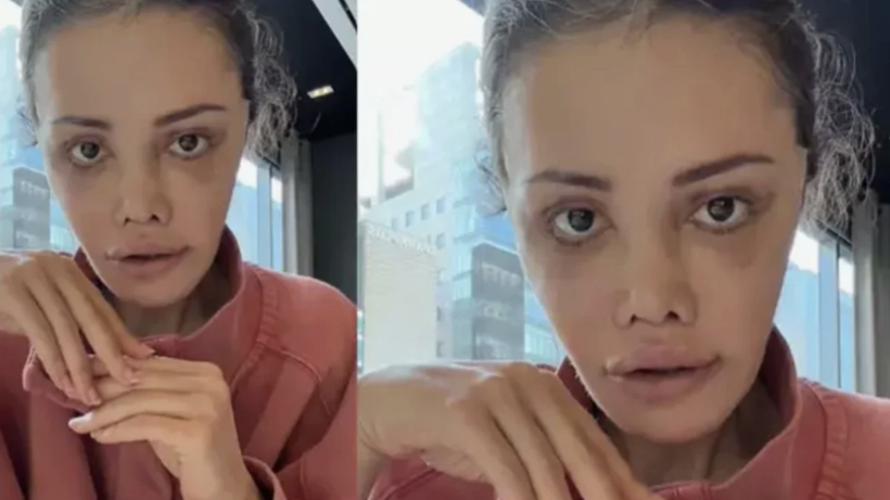 Didem Ceran sağlık durumunu açıkladı! Meğer o hastalıkla mücadele ediyormuş... - Resim: 1