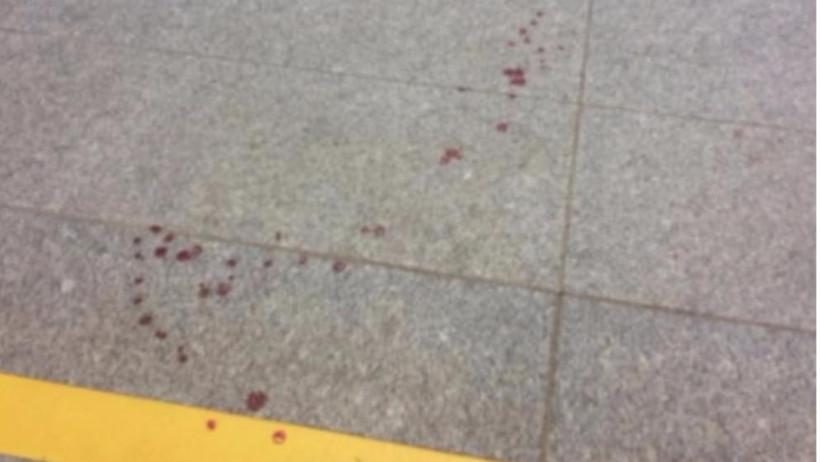 Almanya metroda saldırı olay yerinden ilk görüntüler - Resim: 2