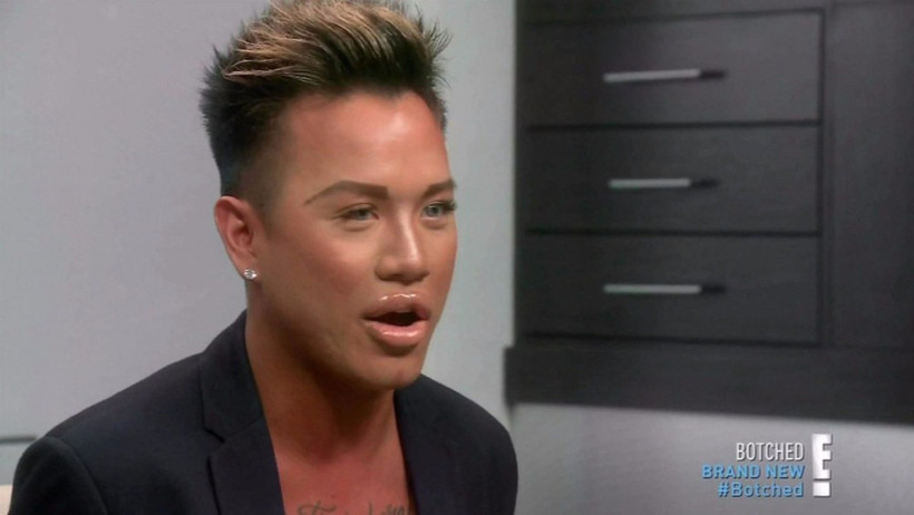 Estetik bağımlısı oldu dudakları kapanmıyor!  - Resim: 3