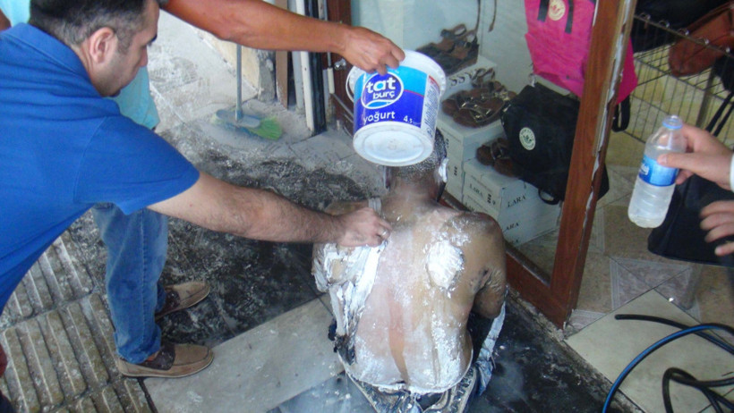 İşsiz genç üzerine benzin döküp ateşe verdi - Resim: 1