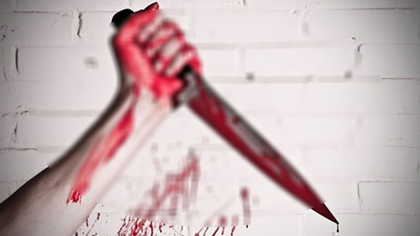 Köpeğin ağzındaki kol ortaya çıkardı! Bunu yapan 80 yaşındaki kadın - Resim: 1