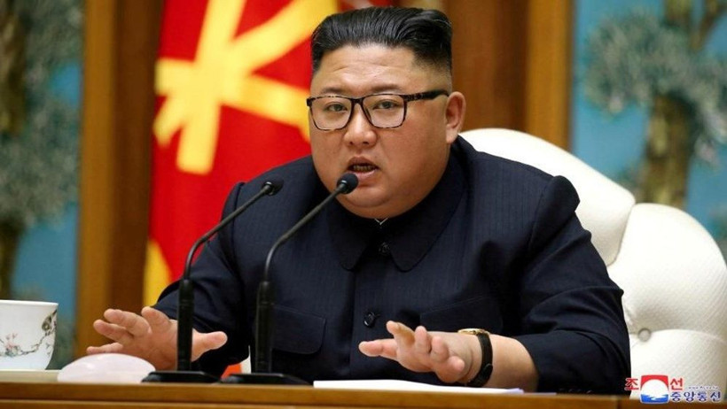 Ölümle pençeleşen Kim Jong-un'un ameliyatıla ilgili bomba detaylar ortaya çıktı - Resim: 1