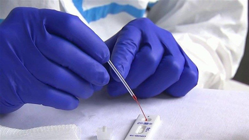 FDA’dan dakikalar içinde sonuç veren ilk koronavirüs antijen testine onay - Resim: 3