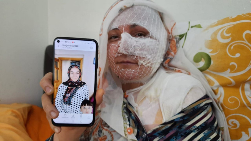 'Seni televizyona çıkaracağım' diyordu! Diyarbakır'da eşini yakan koca bu mesajı atmış - Resim: 3