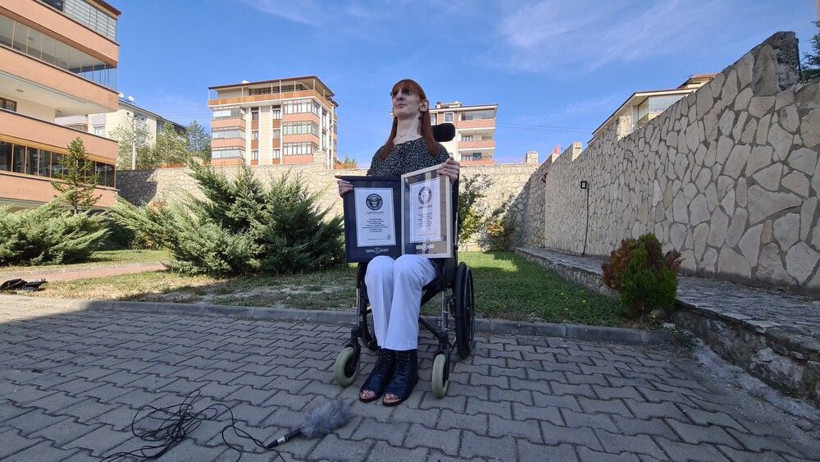 Dünyanın en uzun kadını Karabüklü! 'Gizlemek zorunda kaldım' deyip Rümeysa Gelgi anlattı - Resim: 1