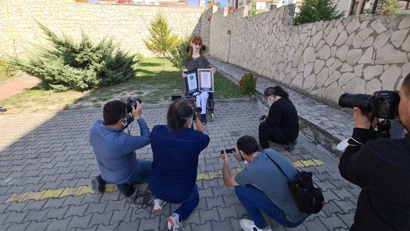 Dünyanın en uzun kadını Karabüklü! 'Gizlemek zorunda kaldım' deyip Rümeysa Gelgi anlattı - Resim: 4