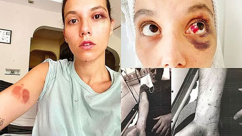 Rubato solisti Özer Arkun'un şiddet davasında mahkeme kararı açıkladı! - Resim: 4