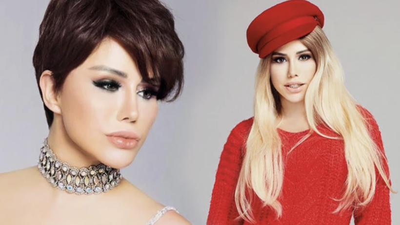 Ceylan'dan estetik itirafı: "Yüzüm kaldırmıyor" - Resim: 1