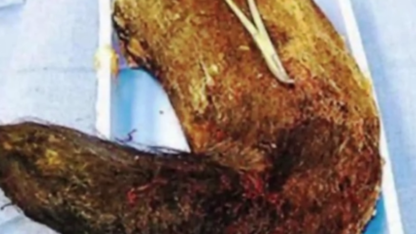 Hamileyim diye doktora gitti karnından çıkanlar şoke etti - Resim: 4