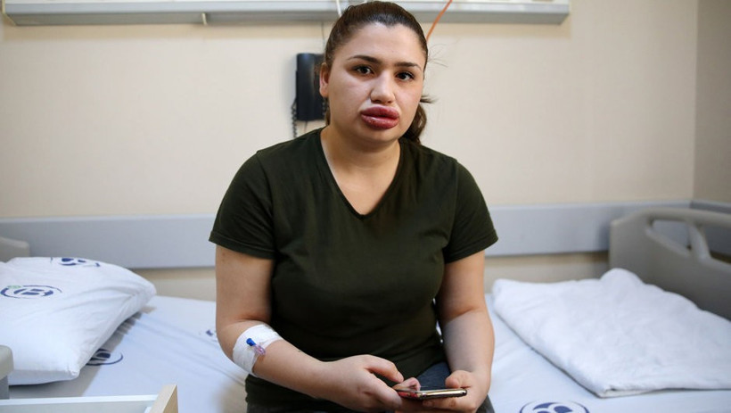 Silikon yaptırmak istemişti hemşire Merve Keleş ilk kez konuştu - Resim: 1