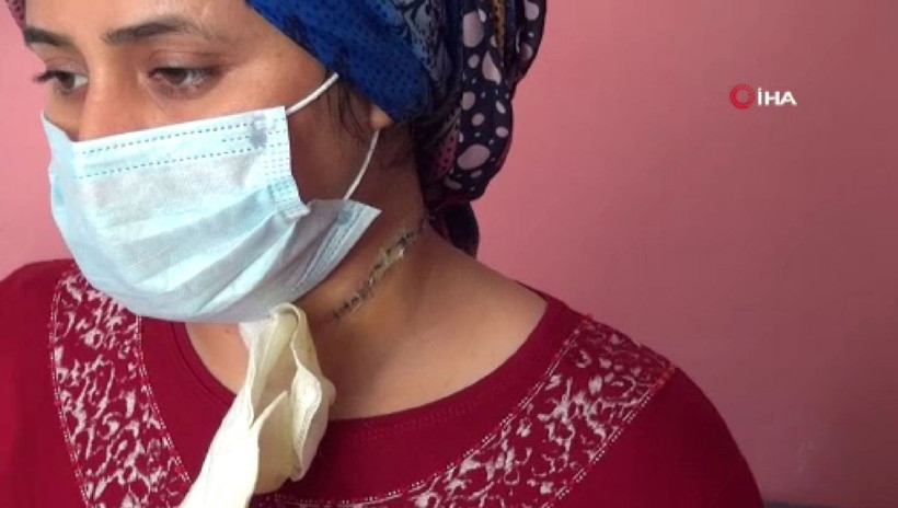 Manisa'da falçatayla eşinin boğazını kesti! Gönderdiği mektuplar şok etti - Resim: 1