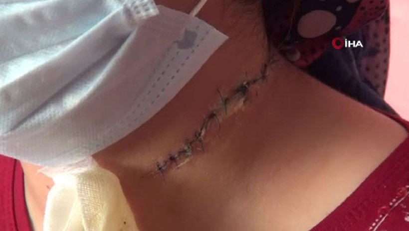 Manisa'da falçatayla eşinin boğazını kesti! Gönderdiği mektuplar şok etti - Resim: 2