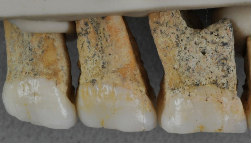 67 bin yıllık fosillerden çıkanlar şaşırttı en eski insan türü keşfedildi - Resim: 2