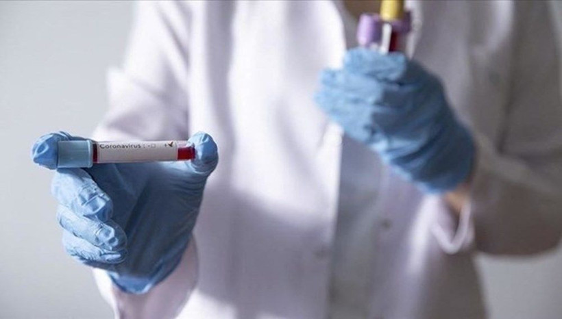 Koronavirüs vaka sayısı dünya genelinde 2 milyon 600 bini aştı - Resim: 1