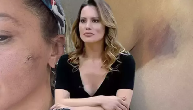 Yıldız Asyalı'dan şok iddia! "Eşim babamı darp etti" - Resim: 1