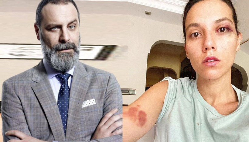 Deniz Bulutsuz 'bu sorular iyi olmuyor' dedi kameralara saldırdı! Ozan Güven darp etmişti - Resim: 3