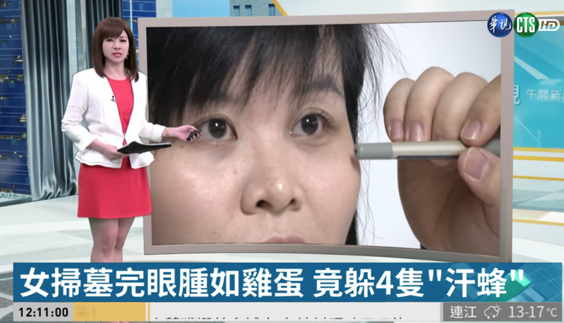 Mezarlıkta ot temizlerken oldu kadının sol gözünden çıkanlar şaşkına çevirdi - Resim: 2