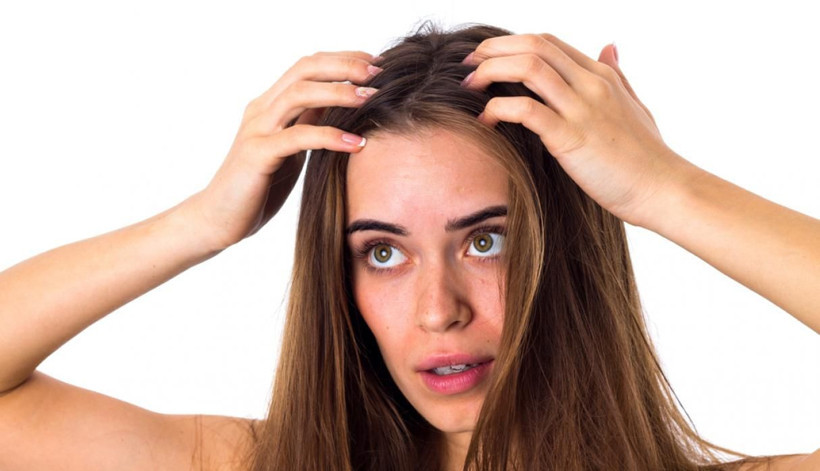 Uzmanı uyardı! Kadınlarda saçlar niye dökülür...Tedavisi var mı? - Resim: 1
