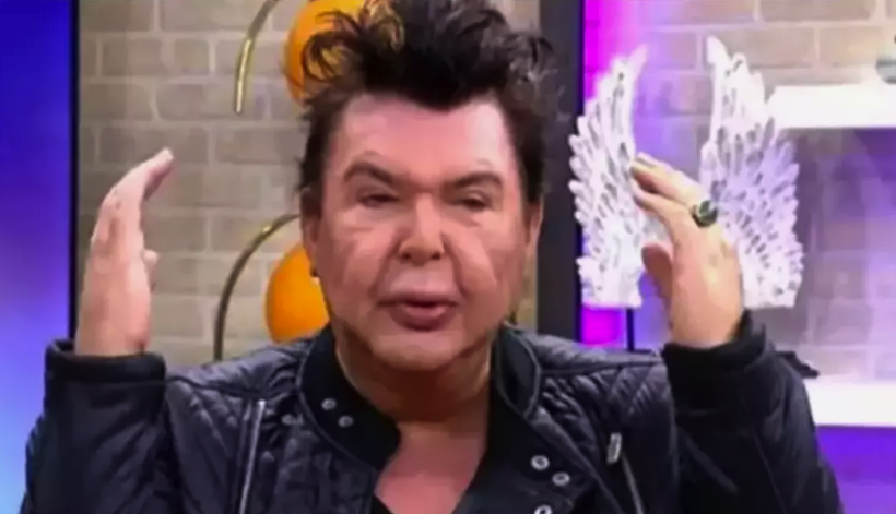 Kuşum Aydın yüzüne yaptırdığı tüm dolgulardan kurtuldu, ameliyat oldu! Son hali olay... - Resim: 2