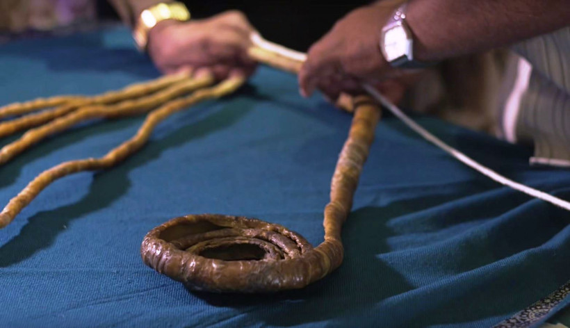 66 yıl uzattığı tırnaklarını sonunda kesti - Resim: 4