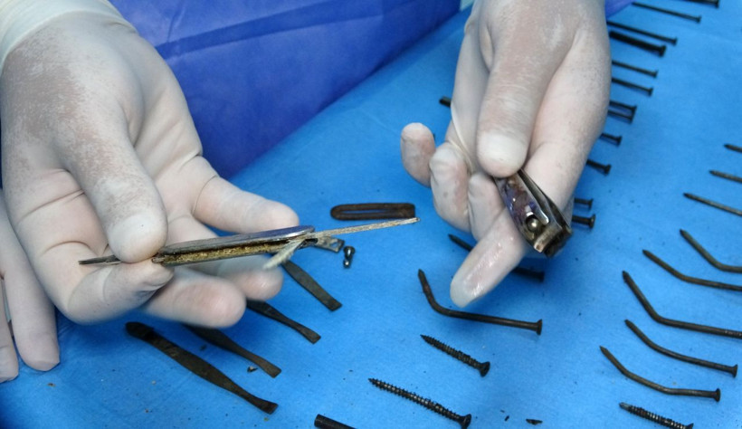 Hepsini yutmuş! Van'da genç kadının midesinden çıktı herkes şaşkın - Resim: 4