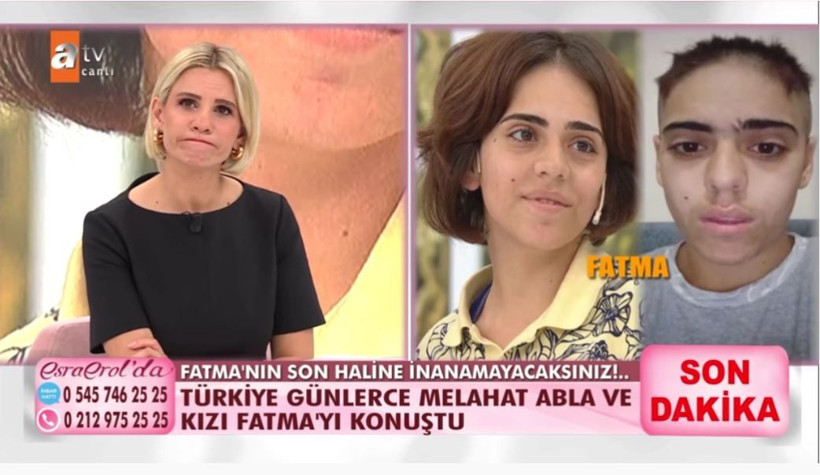 ATV Esra Erol'daki zihinsel engelli Fatma sevgilisi Ahmet, kuması ve onun sevgilisiyle yaşıyor! Rezalet! - Resim: 1