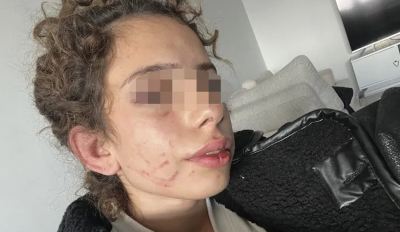 Üniversiteli kıza dehşeti yaşattı! 'Sana bir sürprizim var' dedi sabaha kadar dövdü - Resim: 4